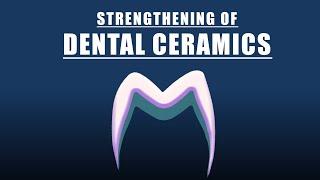 Dental ceramics  Strengthening techniques