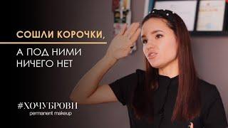 Сошли корочки а под ними нет пигмента?