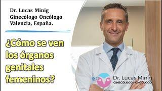 ¿Cómo se ven los órganos genitales femeninos? Dr Lucas Minig Ginecólogo Oncólogo Valencia España.