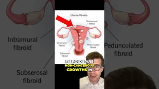 What are uterus FIBROIDS and what causes them? #shorts #health