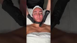 Needle rolling technology brings more effective skin rejuvenation results #beauty #skincare #shorts