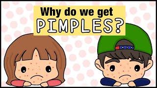 How pimples are formed  How acne forms  Causes of acne & pimples  Whats inside a pimple?