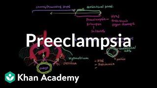 Preeclampsia  Reproductive system physiology  NCLEX-RN  Khan Academy