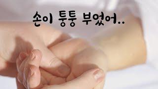 몸이 퉁퉁 부은 임신한 아내가 걱정되는 남편ASMR