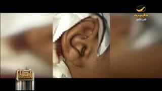 اعتداء وحشي من مدرس بجازان على طفل في الأول الابتدائي