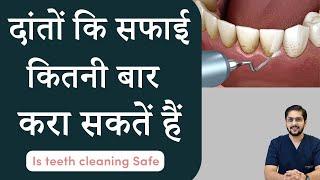 दांतों कि सफाई कितनी बार करा सकते हैं  Is dental cleaning safe for teeth