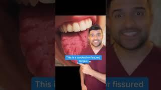 Does Your Tongue Look Weird?  Dentist Explains What Could Be Wrong…