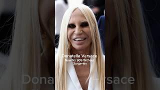 Donatella Versace Now VS Without Surgeries 90s #donatellaversace #versace #shortsfeed #runway