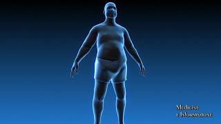 Diabesità e Sindrome Metabolica rischi parametri  e come contrastarle con interventi integrati