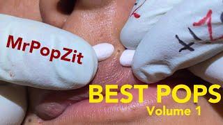 Top Pops volume 1. All kinds of pops from MrPopZit. Some new some old.