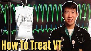 How To Treat VTach  Ventricular Tachycardia - Easy