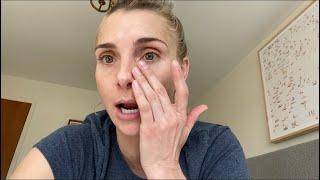 TRETINOIN FOR EYE WRINKLES  MY THOUGHTS AND EXPERIENCE