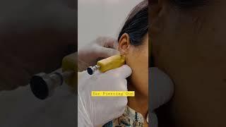 Ear piercing gun Dr Nakul Somani #shortsvideo #plasticsurgeon #shortsfeed #cosmeticsurgery #jaipur