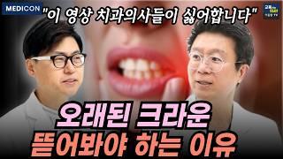 임플란트 하지 않으려면 오래된 크라운 다시 확인해야 합니다.