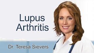 Lupus arthritis