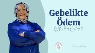 Gebelikte Ödem Neden Olur_?