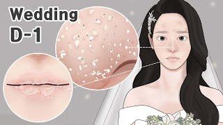 ASMR Wedding D-1  Pimple Popping Blackhead Removal Lip Scrub TOTAL SKINCARE ANIMATION  LULUPANG