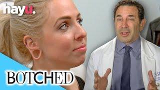 Can Dr. Paul Nassif Fix Kathleens Over Stretched Earlobes?  Season 3  Botched