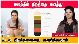 மலம் நிறம் மாறி போவதற்கு காரணம் என்ன ?  Your Stool Says About Your Health  #healthtips #health