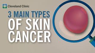 3 Types of Skin Cancer