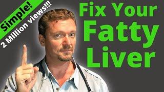 FATTY LIVER How to Fix It Better than Any Pill 2024