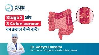 Stage 2 और 3 colon cancer का इलाज कैसे करें?  Dr Aditya Kulkarni  Oasis Clinic