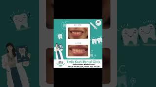 Smile Kochi Dental Clinic  Kadavanthara  PalarivattomSmile Kochi Dental Clinic