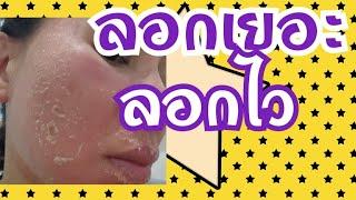 EP.51  #ผลัดเซลส์ผิว   วิธีทำให้หน้า  ลอกเยอะ หน้าไม่ดำ  ลอกไว ใสทุกคน  ทำตามได้เลย