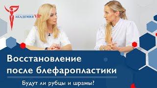 Блефаропластика реабилитация после блефаропластики. Рубцы и шрамы после блефаропластики