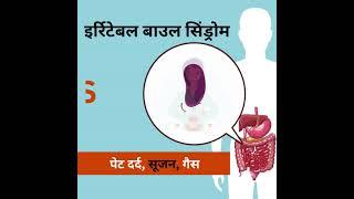 Irritable Bowel Syndrome  इर्रिटेबल बाउल सिंड्रोम Care Pack by Deep Ayurveda