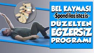 Bel Kayması Egzersizleri  - Bel Kayması Tedavisi - Spondilozistezis