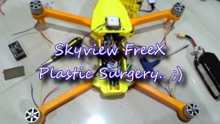 freeX plastic surgery