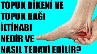 TOPUK DİKENİ VE TOPUK BAĞI İLTİHABI NEDİR VE NASIL TEDAVİ EDİLİR?