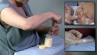 Finger Feeding to Supplement a Breastfeeding Infant