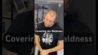 Covering my Bald Head To Thick Hair