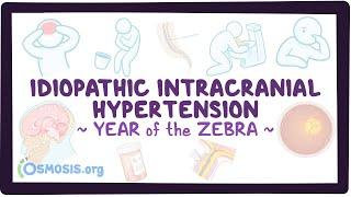 Idiopathic intracranial hypertension Year of the Zebra