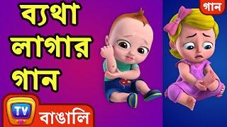 ব্যথা লাগার গান The Boo Boo Song - Bangla Rhymes For Children - ChuChu TV