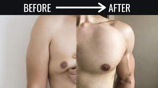 Burn CHEST FAT Forever 5 आसान Steps Man Boobs & Gynecomastia Solution