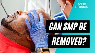 Can Scalp Micropigmentation Be Removed? A Hawaii SMP Practitioner Explains