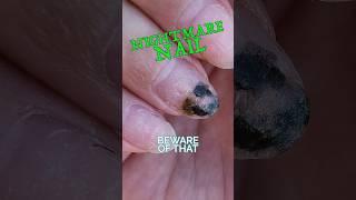 WATCH OUT Your Nails Could Have The Greenies 