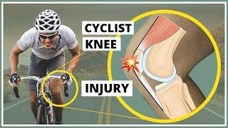 Pre-patellar fascia injury also known as Cyclists knee explanation diagnosis and treatment