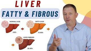 Fatty Liver And Fibrous Liver Key to Prevent Chronic Diseases