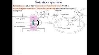 Toxic shock syndrome