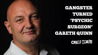 Gangster turned ‘Psychic Surgeon’ Gareth Quinn