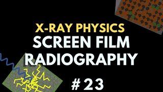 Screen Film Radiography  X-ray Physics  Radiology Physics Course #30
