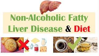 Non-Alcoholic Fatty Liver Disease & Diet  Diets to Prevent and Reduce Severity of NAFLD