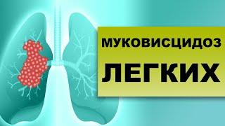 МУКОВИСЦИДОЗ. ЛЕЧЕНИЕ СИМПТОМЫ ДИАГНОСТИКА