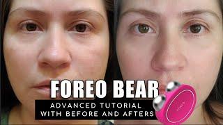 FOREO BEAR  BEFORE & AFTERS ADVANCED TUTORIAL AND TIPS TO GET THE BEST RESULTS