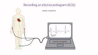 What is an ECG or  EKG?  How an ECG is measured and what it records
