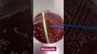 Microbiology lab diagnosis of Moraxella intact colonies